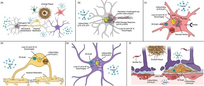 The Role of Senescent Cells in Alzheimer's Disease