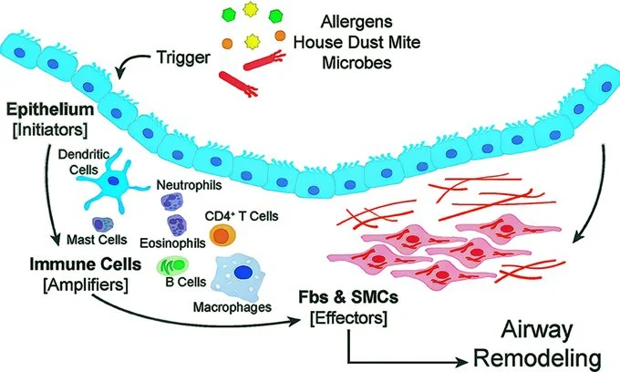 Anti-inflammatory Effects of Bronchogen on Airway Inflammation in Patients with Asthma and Chronic Bronchitis